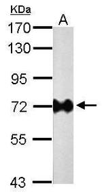 Helicobacter pylori Urease B Monoclonal Antibody (GT1263)