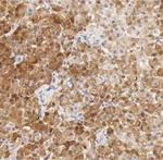 Calretinin Monoclonal Antibody (SP13)