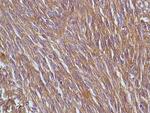 DOG-1 Antibody in Immunohistochemistry (Paraffin) (IHC (P))