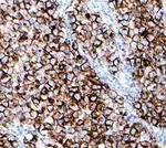 Placental Alkaline Phosphatase Recombinant Rabbit Monoclonal Antibody (SP15)