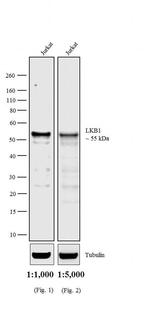 Rat anti-Mouse IgG2a (Heavy chain) Secondary Antibody, HRP