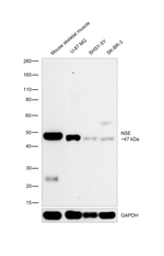 NSE Antibody in Western Blot (WB)