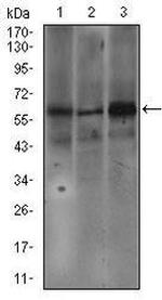 FceR1 alpha Monoclonal Antibody (1F2A9)