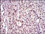 PCNA Antibody in Immunohistochemistry (Paraffin) (IHC (P))