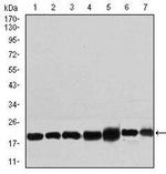 RPL18A Antibody in Western Blot (WB)
