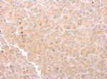 Citrate Synthase Antibody in Immunohistochemistry (Paraffin) (IHC (P))