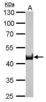 Citrate Synthase Antibody in Western Blot (WB)