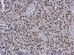 HNF1A Monoclonal Antibody (GT4110)