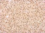 IP6K1 Monoclonal Antibody (GT10611)