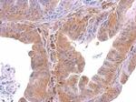 SMYD3 Antibody in Immunohistochemistry (Paraffin) (IHC (P))