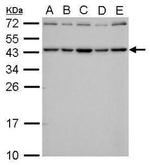 SMYD3 Antibody in Western Blot (WB)
