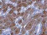 CBS Monoclonal Antibody (GT519)