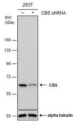 CBS Antibody in Western Blot (WB)