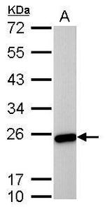 TAGLN Antibody in Western Blot (WB)