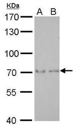 SAMHD1 Antibody in Western Blot (WB)