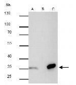 Strep Tag Antibody in Immunoprecipitation (IP)