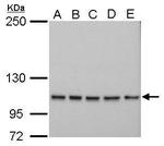 ADAR Antibody in Western Blot (WB)