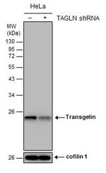 TAGLN Antibody in Western Blot (WB)