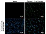 Dengue Virus Type 2 Envelope Monoclonal Antibody (GT214)