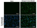 Dengue Virus Type 2 NS3 Monoclonal Antibody (GT2811)