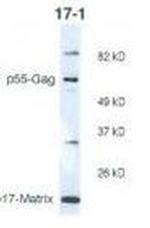 HIV1 p17 Monoclonal Antibody (17-1)