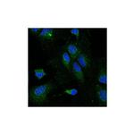 LPL Monoclonal Antibody (5D2)
