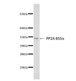 PP2A B-alpha Monoclonal Antibody (2G9)