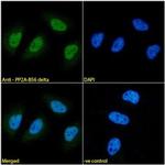 PPP2R5D Antibody in Immunocytochemistry (ICC/IF)