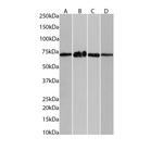 PPP2R5D Antibody in Western Blot (WB)