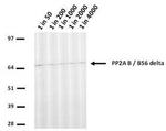 PPP2R5D Antibody in Western Blot (WB)