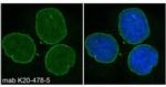 Nesprin 2 Monoclonal Antibody (K20-478-5)