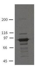 PKP3 Monoclonal Antibody (7F6)