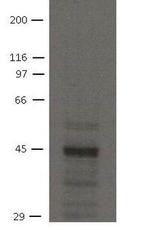 NHERF2 Monoclonal Antibody (32B6)