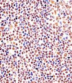 EZH2 Antibody in Immunohistochemistry (Paraffin) (IHC (P))