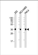 UCH37 Antibody in Western Blot (WB)