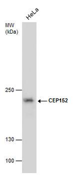 CEP152 Monoclonal Antibody (P1285)