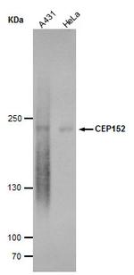 CEP152 Monoclonal Antibody (P1315)