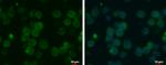 MCT1 Monoclonal Antibody (P14612)