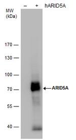 ARID5A Antibody in Western Blot (WB)