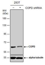 COPD Antibody in Western Blot (WB)