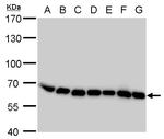 COPD Antibody in Western Blot (WB)