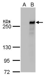 TET2 Monoclonal Antibody (P411)