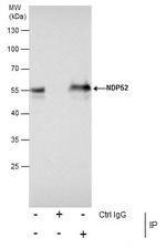 CALCOCO2 Antibody in Immunoprecipitation (IP)