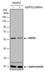 CALCOCO2 Antibody in Western Blot (WB)