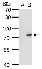 SLU7 Monoclonal Antibody (P759)