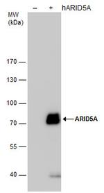 ARID5A Monoclonal Antibody (P921)