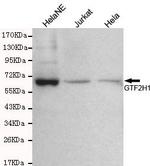 GTF2H1 Monoclonal Antibody (5B7)