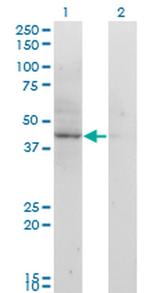 ACAT2 Antibody in Western Blot (WB)