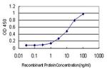 ALDH3B2 Antibody in ELISA (ELISA)