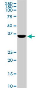 CDX4 Antibody in Western Blot (WB)